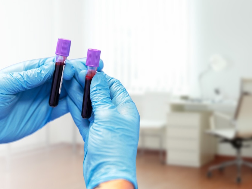 Odběry krve Poliklinika AGEL Nymburk